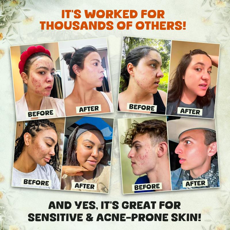 Whipped Beef Tallow and Honey Balm,Grass Fed Grass Finished Face Cream